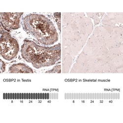 OSBP2 Antibody, Novus Biologicals 0.1mL; Unlabeled:Antibodies, Polyclonal